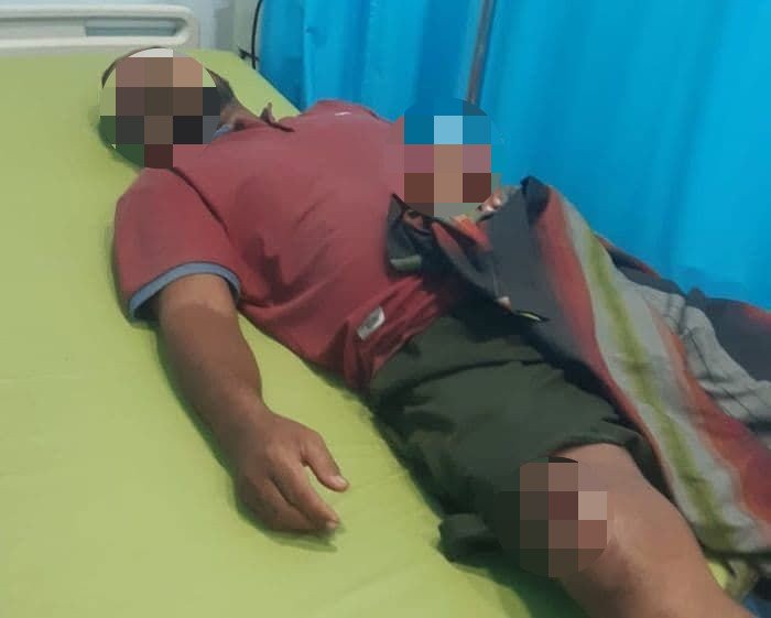 Kepala Pedagang Ikan Pajak di Brayan Dibacok Begal di Jl. Yos Sudarso Titi Papan Medan