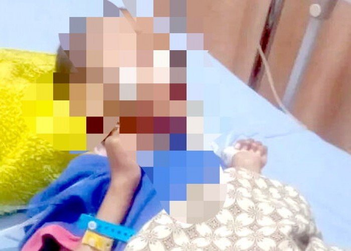 Tragedi Ahmad Maulana: Cermin Kegagalan Sistem Penanganan Gizi Buruk di Bogor